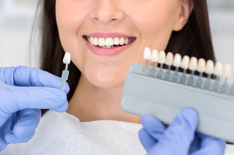Odontología estética: fundas dentales , estética dental en nuestra clínica dental Doctores Arena en Chamartín