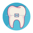 Ortodoncia - dientes alineados - brackets invisibles