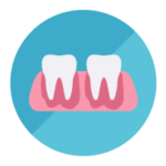 periodoncia - enfermedades periodontales: gingivitis y periodontitis