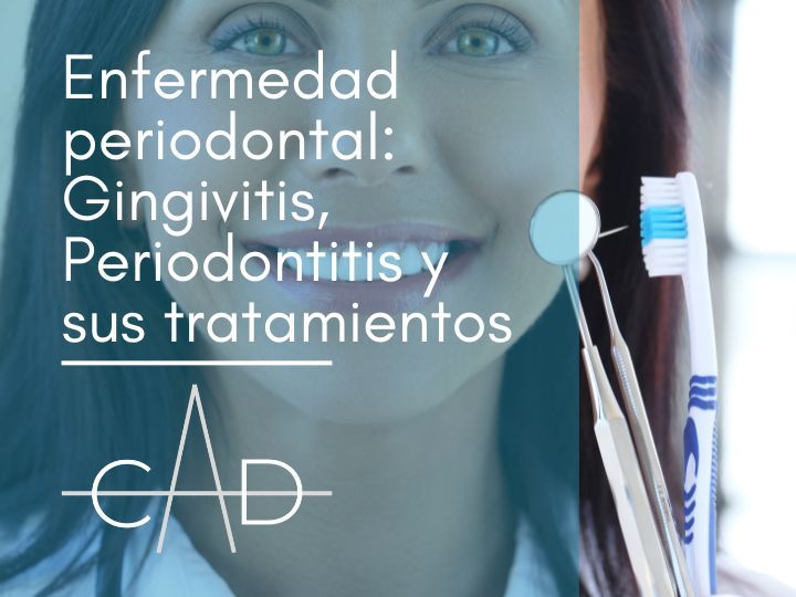 Enfermedad periodontal gingivitis, periodontitis, piorrea y sus tratamientos