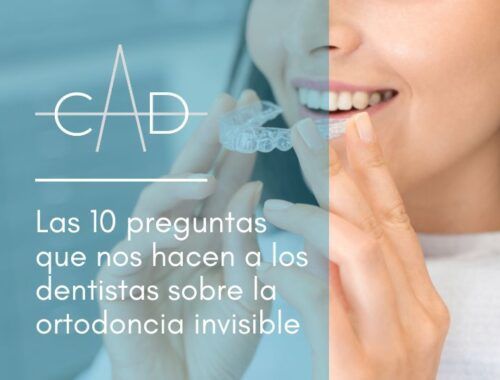 Las 10 preguntas que nos hacen a los dentistas sobre ortodoncia invisible