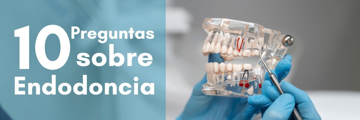 férula de descarga - qué es una endodoncia. Cómo se realiza. Cuánto se tarda