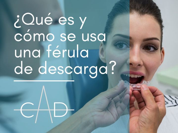qué es y cómo se usa una férula de descarga