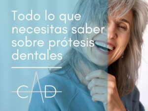 todo lo que necesitas saber sobre prótesis dentales