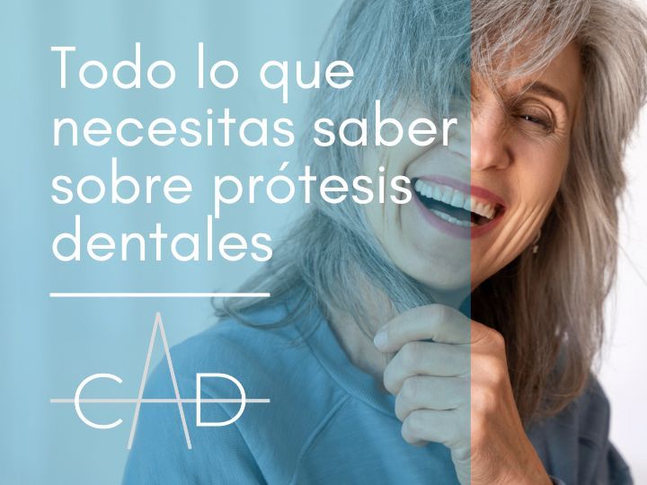 todo lo que necesitas saber sobre prótesis dentales