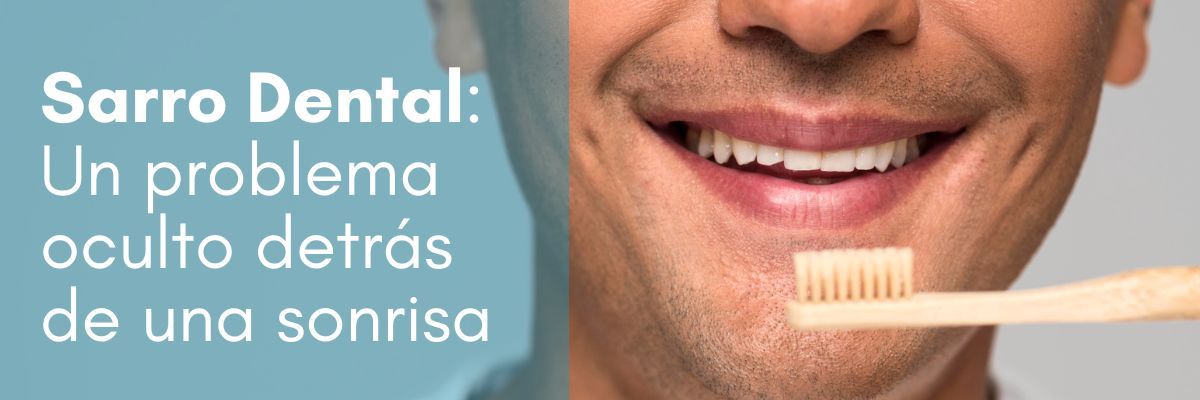 Sarro dental, pérdida de dientes