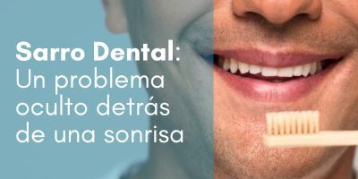 Sarro dental, higienista dental, periodoncia
