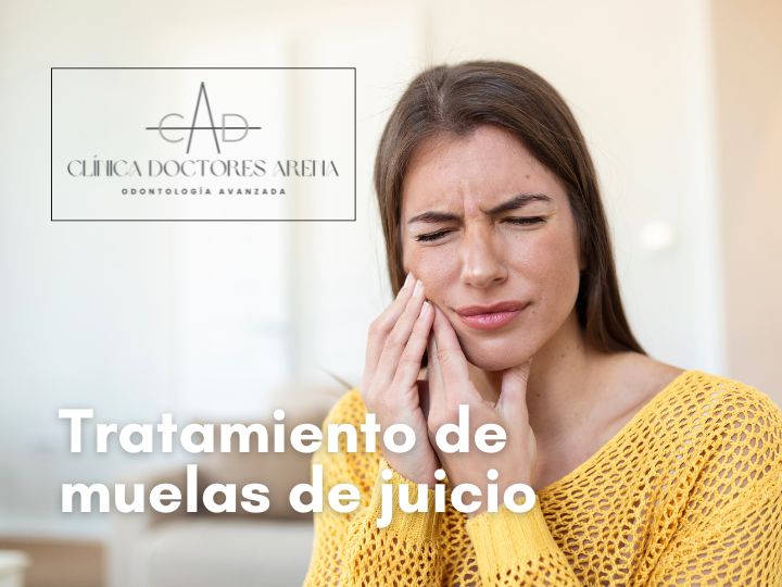 extraer muelas del juicio