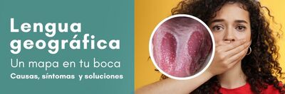 lengua geográfica y salud dental