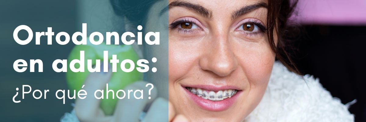 Ortodoncia en adultos por que ahora