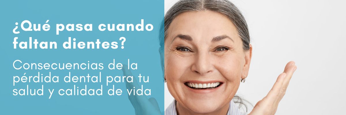 ¿Qué pasa cuando faltan dientes Consecuencias de la pérdida dental. Clínica dental Dres. Arena en Chamartín