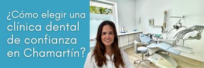 Cómo elegir una clínica dental de confianza en Chamartín nuevo post. Clínica dental Dres. Arena en Chamartín