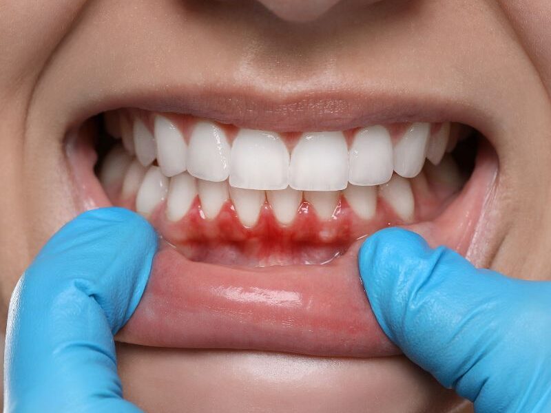 Periodoncia en Chamartín. Especialistas en Periodoncia Dres. Arena