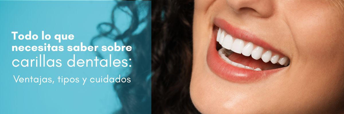 Todo lo que necesitas saber sobre carillas dentales. carillas dentales en Chamartín. Clínica dental Dres. Arena especialistas en odontología estética