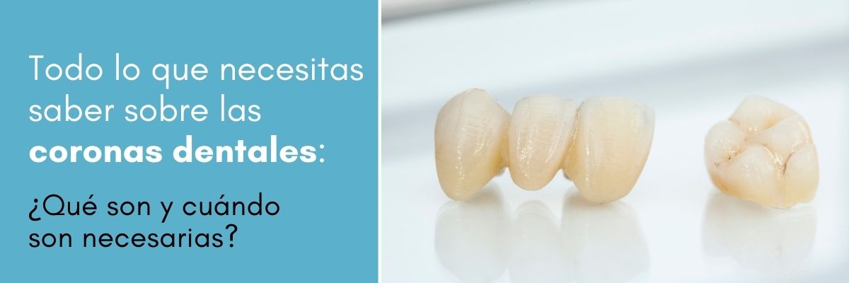 Todo lo que necesitas saber sobre coronas dentales. Clínica dental Dres. Arena en Chamartín