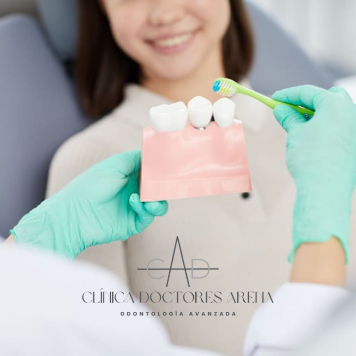 Periodoncia en Clínica doctores Arena- dentistas en Chamartín