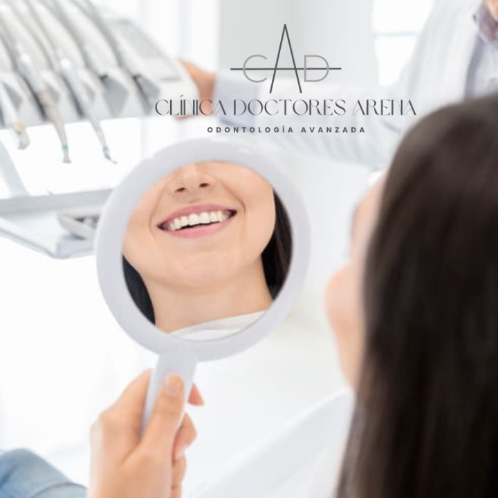 blanqueamiento dental en Clínica doctores Arena- dentistas en Chamartín