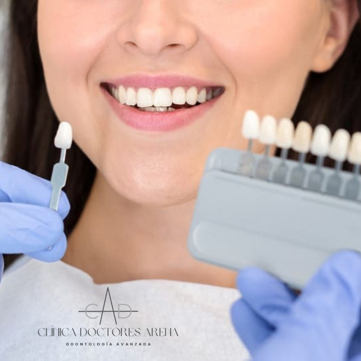 estética dental en Clínica doctores Arena- dentistas en Chamartín