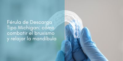 Férula de Descarga Tipo Michigan cómo combatir el bruxismo y relajar la mandíbula