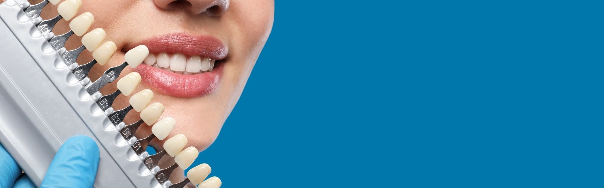 estética dental en Chamartín Dres. Arena