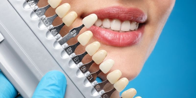 estética dental en Chamartín Doctores Arena