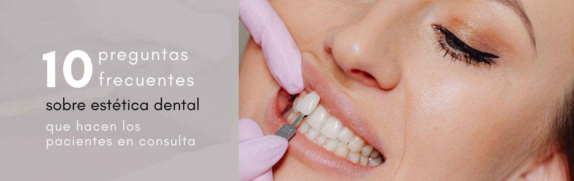 preguntas frecuentes sobre estética dental