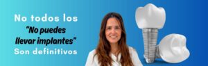 IMPLANTES DENTALES - Dres .Arena dentistas de confianza en Chamartín