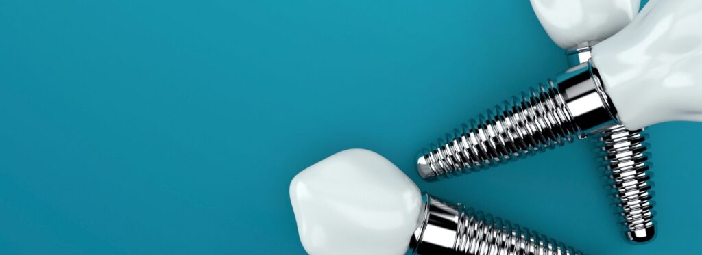 guía sobre implantes dentales en Madrid