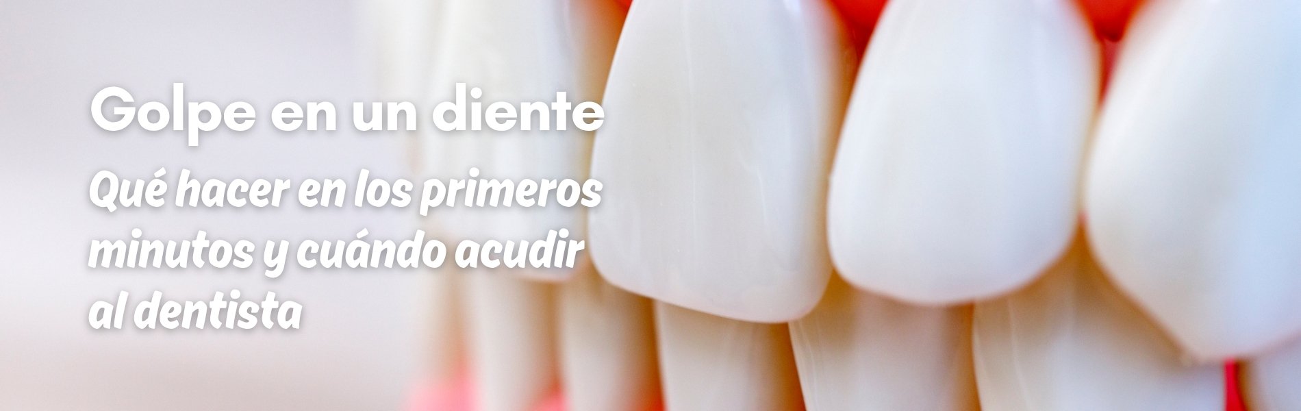 golpe en un diente